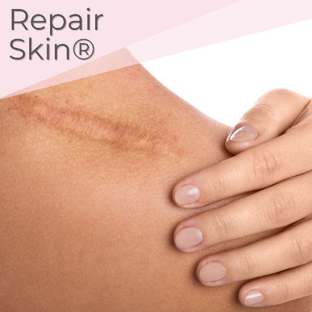 Le soin Repair Skin est le soin idéal pour réparer et aider à la cicatrisation de vos cicatrices et de vos vergetures