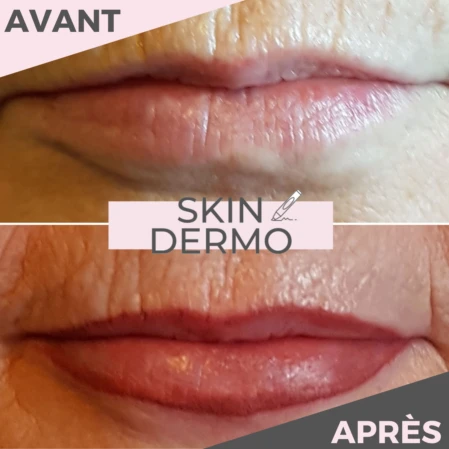 maquillage-permanent-levres-glossy-lips-skin-dermo Photo avant/après d'un maquillage permanent des lèvres